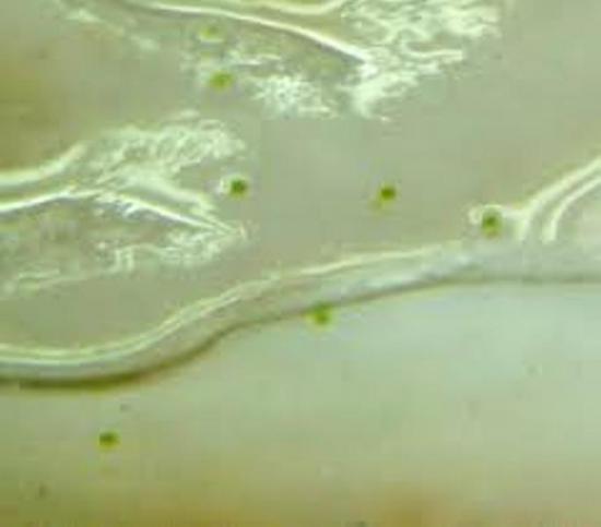 phalaenopsise paljundamine seemnete abil